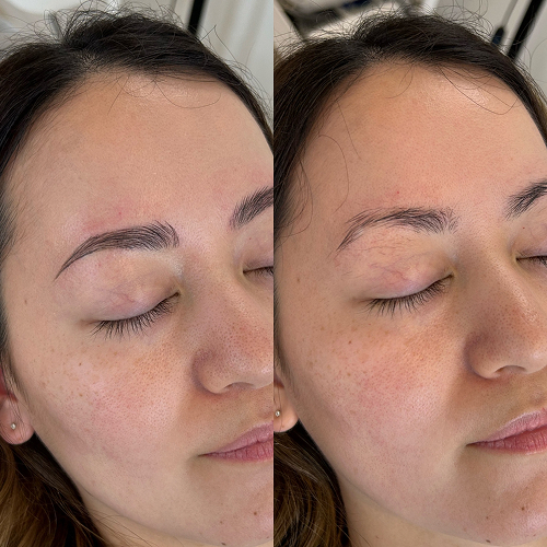 形の補正で印象UP​​​​​​​